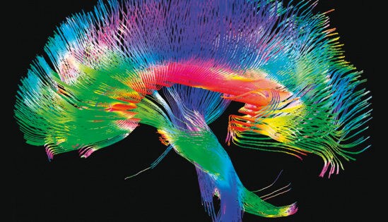 El cerebro humano trabaja al borde de la locura